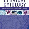 Handbook of Cervical Cytology: Special Emphasis on Liquid Based Cytology (PDF Book)