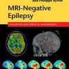 MRI-Negative Epilepsy: Evaluation and Surgical Management (EPUB)