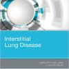 Interstitial Lung Disease (PDF)