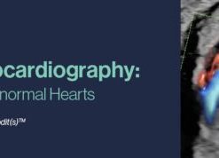 2021 Fetal Echocardiography: Normal and Abnormal Hearts (CME VIDEOS)