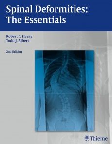 Spinal Deformities: The Essentials, 2nd Edition (PDF)