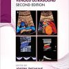 Venous Ultrasound, 2ed (PDF Book)