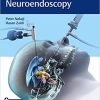 Controversies in Neuroendoscopy (HQ PDF)