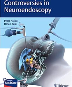 Controversies in Neuroendoscopy (HQ PDF)