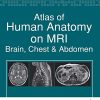 Atlas of Human Anatomy on MRI: Brain, Chest and Abdomen (PDF)