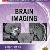 Radiology Case Review Series: Brain Imaging (PDF)
