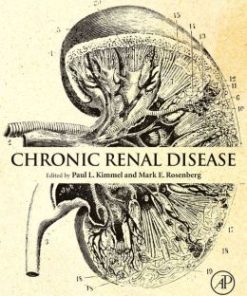 Chronic Renal Disease (PDF)