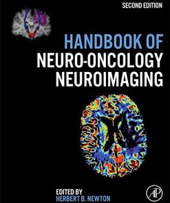 Handbook of Neuro-Oncology Neuroimaging, 2nd Edition (PDF)