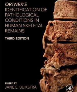 Ortner’s Identification of Pathological Conditions in Human Skeletal Remains, 3rd Edition