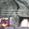Coronary Microvascular Obstruction in Acute Myocardial Infarction: From Mechanisms to Treatment (PDF)