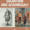 Gigantism and Acromegaly: Genetics, Diagnosis, and Treatment (PDF Book)