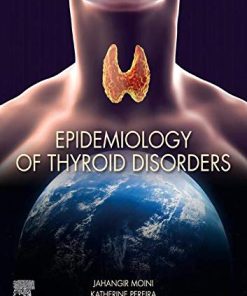 Epidemiology of Thyroid Disorders (EPUB)