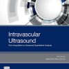 Intravascular Ultrasound: From Acquisition to Advanced Quantitative Analysis (EPUB)