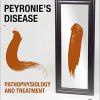 Peyronie’s Disease: Pathophysiology and Treatment (PDF)