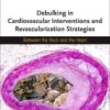 Debulking in Cardiovascular Interventions and Revascularization Strategies: Between a Rock and the Heart 2022 Original PDF