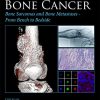 Bone Cancer: Bone Sarcomas and Bone Metastases – From Bench to Bedside, 3rd Edition (PDF)