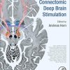 Connectomic Deep Brain Stimulation (PDF Book)
