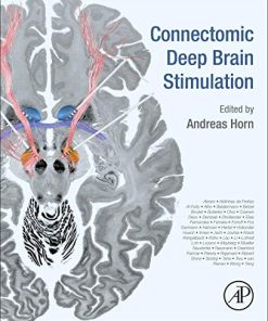 Connectomic Deep Brain Stimulation (PDF)