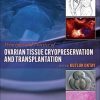Principles and Practice of Ovarian Tissue Cryopreservation and Transplantation (PDF)