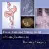 Prevention and Management of Complications in Bariatric Surgery (PDF)