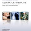 Challenging Concepts in Respiratory Medicine: Cases with Expert Commentary (PDF)