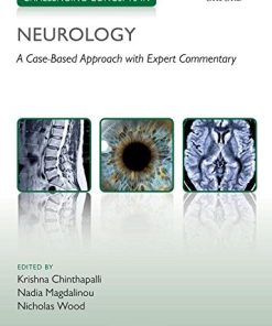 Challenging Concepts in Neurology: Cases with Expert Commentary (PDF)