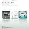 Challenging Concepts in Oncology (EPUB)