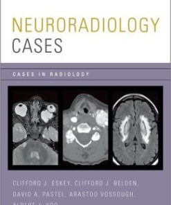 Neuroradiology Cases (Cases in Radiology)