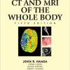 CT and MRI of the Whole Body, 2-Volume Set, 5th Edition (PDF)