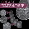 Breast Tomosynthesis (PDF)