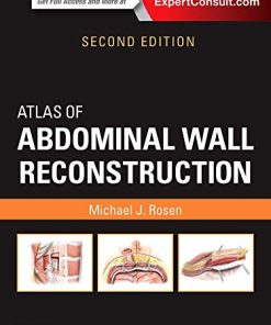 Atlas of Abdominal Wall Reconstruction, 2nd Edition (Videos, Organized)