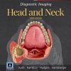 Diagnostic Imaging: Head and Neck, 3e (PDF)