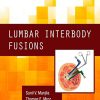 Lumbar Interbody Fusions (PDF)