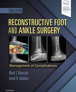 Reconstructive Foot and Ankle Surgery: Management of Complications, 3rd Edition (Videos, Organized)