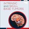 Intrinsic and Skull Base Tumors: Neurosurgery: Case Management Comparison Series (PDF Book)