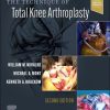 The Technique of Total Knee Arthroplasty, 2nd edition (PDF)