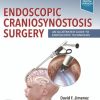 Endoscopic Craniosynostosis Surgery: An Illustrated Guide to Endoscopic Techniques (Original PDF from Publisher)