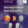 Unicompartmental Knee Arthroplasty 2022 Original PDF