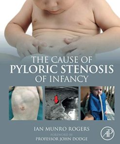 The Cause of Pyloric Stenosis of Infancy (PDF)