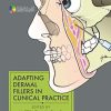 Adapting Dermal Fillers in Clinical Practice (PDF)