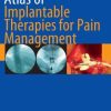 Atlas of Implantable Therapies for Pain Management (PDF)