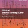 Clinical Electrocardiography: A Textbook, 4th Edition (PDF)