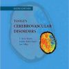 Toole’s Cerebrovascular Disorders, 6th Edition (PDF)