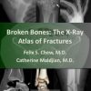 Broken Bones: The X-Ray Atlas of Fractures (EPUB)