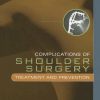 Complications of Shoulder Surgery: Treatment and Prevention (PDF Book)