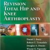 Revision Total Hip and Knee Arthroplasty (PDF)