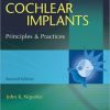 Cochlear Implants: Principles and Practices, 2nd Edition