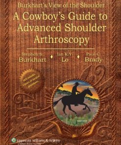 Burkhart’s View of the Shoulder: A Cowboy’s Guide to Advanced Shoulder Arthroscopy (PDF)