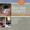 Macular Surgery, 2nd Edition (PDF Book)