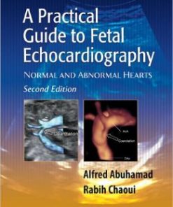 A Practical Guide to Fetal Echocardiography: Normal and Abnormal Hearts, 2nd Edition (EPUB)